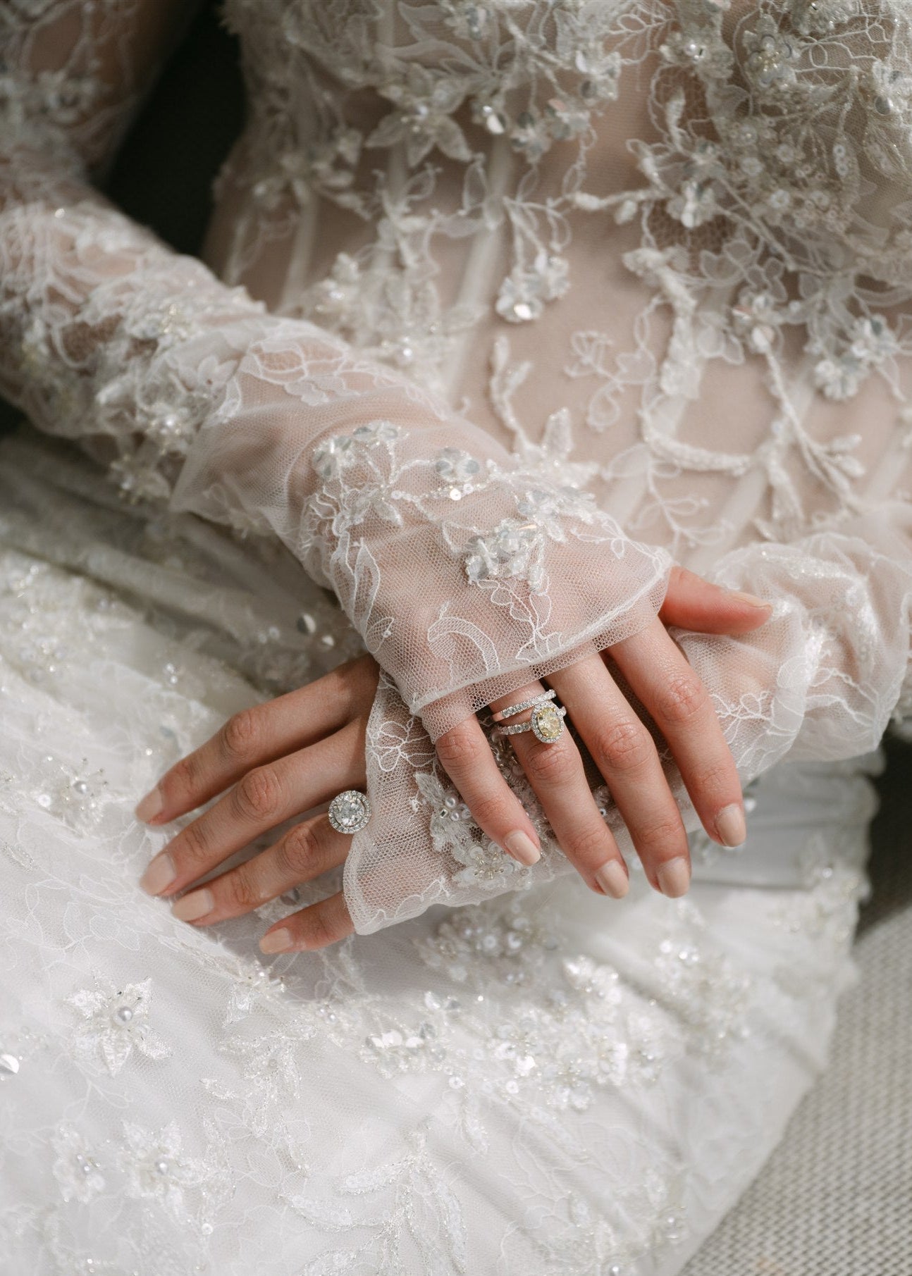 Close-up of a person wearing a wedding dress with lace gloves and rings.